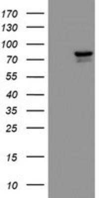 Western Blot: KIF2C Antibody (OTI1C5)Azide and BSA Free [NBP2-71667]
