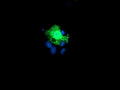Immunocytochemistry/ Immunofluorescence: KIF2C Antibody (OTI1C5) [NBP2-01064]