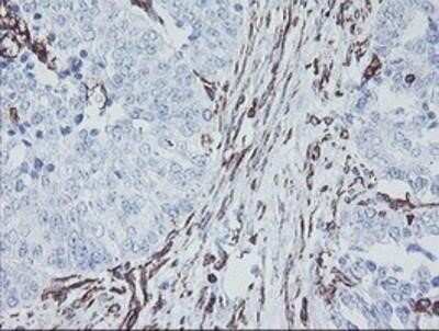 Immunohistochemistry-Paraffin: KIF2C Antibody (OTI1C5) [NBP2-01064]