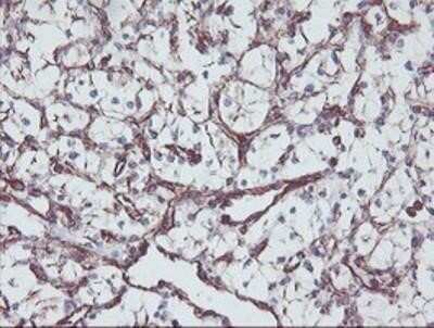 Immunohistochemistry-Paraffin: KIF2C Antibody (OTI1C5) [NBP2-01064]