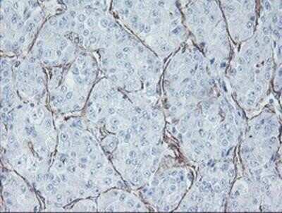 Immunohistochemistry-Paraffin: KIF2C Antibody (OTI1C5) [NBP2-01064]