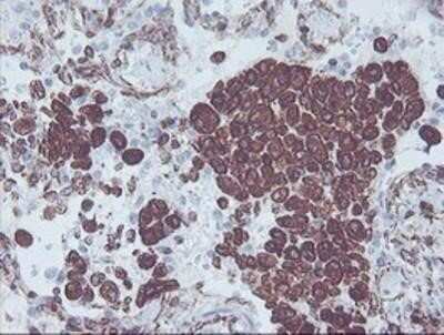 Immunohistochemistry-Paraffin: KIF2C Antibody (OTI1C5) [NBP2-01064]