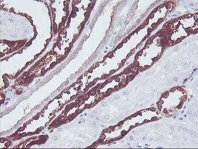 Immunohistochemistry-Paraffin: KIF2C Antibody (OTI1C5) [NBP2-01064]