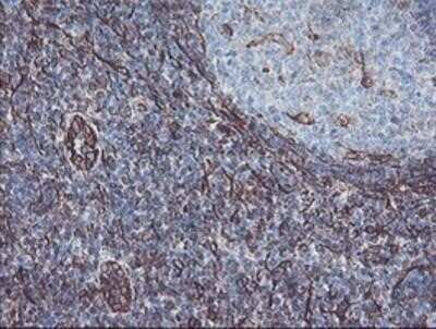 Immunohistochemistry-Paraffin: KIF2C Antibody (OTI1C5) [NBP2-01064]