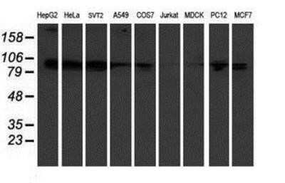 Western Blot: KIF2C Antibody (OTI1C5) [NBP2-01064]