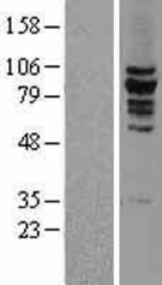 Western Blot: KIF2C Overexpression Lysate [NBL1-12294]