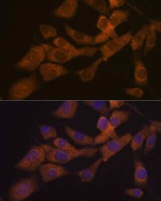 Immunocytochemistry/ Immunofluorescence: KIF3A Antibody (1C8K4) [NBP3-16657]