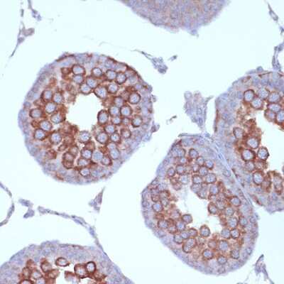 Immunohistochemistry-Paraffin: KIF3A Antibody (1C8K4) [NBP3-16657]