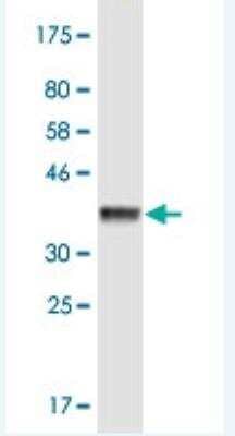 Western Blot: KIF3B Antibody (8H4) [H00009371-M01-100ug]