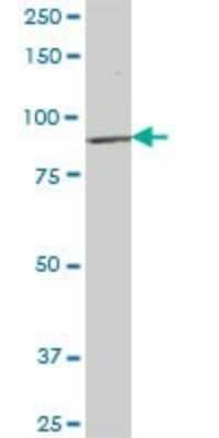 Western Blot: KIF3B Antibody [H00009371-B01P]