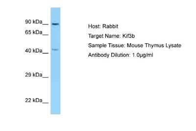 Western Blot: KIF3B Antibody [NBP2-82236]