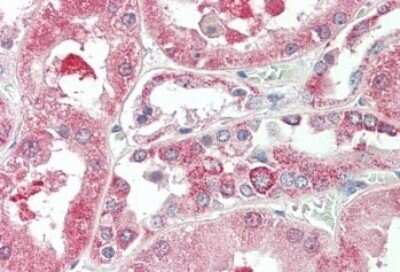 Immunohistochemistry-Paraffin: KIF6 Antibody [NBP1-44066]