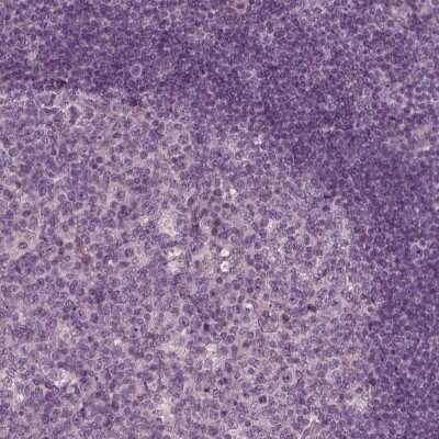 Immunohistochemistry-Paraffin: KIF6 Antibody [NBP1-86767]