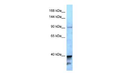 Western Blot: KIF7 Antibody [NBP2-85154]