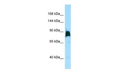 Western Blot: KIF7 Antibody [NBP2-85155]