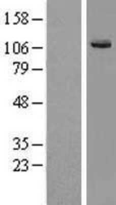 Western Blot: KIF7 Overexpression Lysate [NBL1-12297]