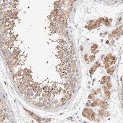 Immunohistochemistry: KIF9 Antibody [NBP1-82772]