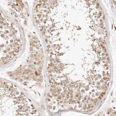 Immunohistochemistry-Paraffin: KIF9 Antibody [NBP1-82771]