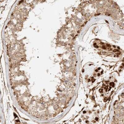 Immunohistochemistry-Paraffin: KIF9 Antibody [NBP1-82773]