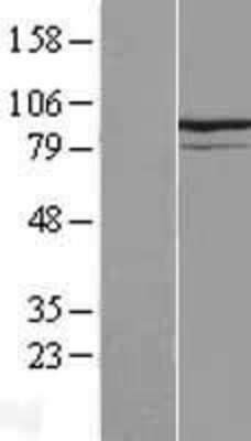 Western Blot: KIF9 Overexpression Lysate [NBL1-12298]