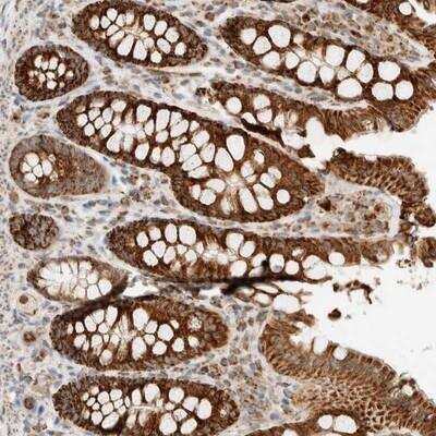 Immunohistochemistry-Paraffin: KIFAP3 Antibody [NBP1-81568]