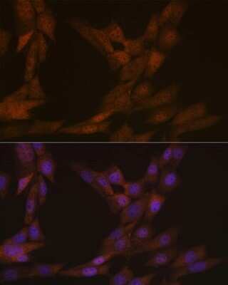 Immunocytochemistry/ Immunofluorescence: KIFC1 Antibody (10M10J4) [NBP3-15248]