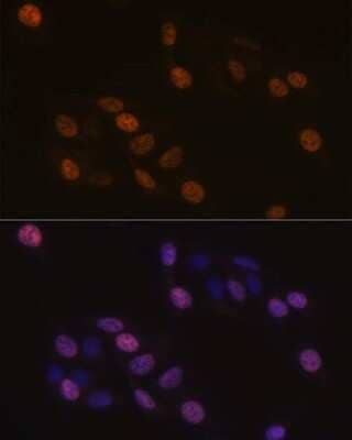 Immunocytochemistry/ Immunofluorescence: KIFC1 Antibody (10M10J4) [NBP3-15248]