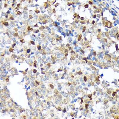 Immunohistochemistry-Paraffin: KIFC1 Antibody (10M10J4) [NBP3-15248]