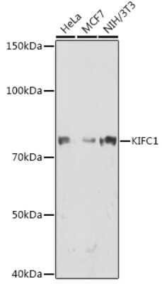 Western Blot: KIFC1 Antibody (10M10J4) [NBP3-15248]