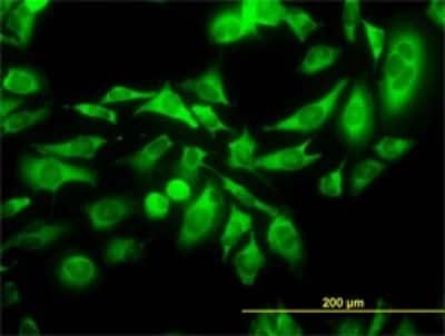 Immunocytochemistry/ Immunofluorescence: KIFC1 Antibody (2B9) [H00003833-M01]