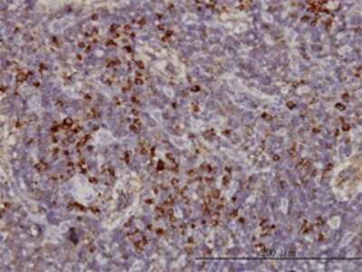 Immunohistochemistry-Paraffin: KIFC1 Antibody (2B9) [H00003833-M01]