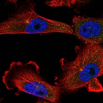 Immunocytochemistry/ Immunofluorescence: KIFC1 Antibody [NBP2-47407]