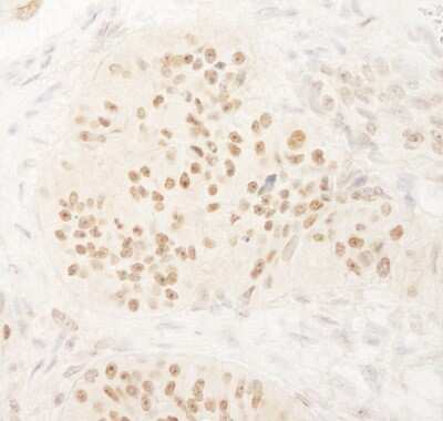 Immunohistochemistry-Paraffin: KIFC1 Antibody [NB100-40844]