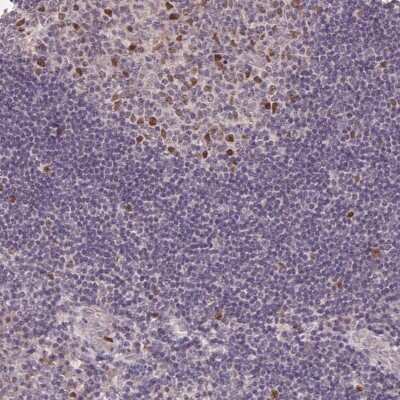 Immunohistochemistry: KIFC1 Antibody [NBP2-49370]