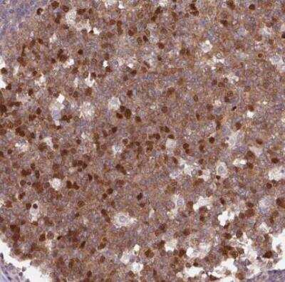 Immunohistochemistry-Paraffin: KIFC1 Antibody [NBP2-47407]
