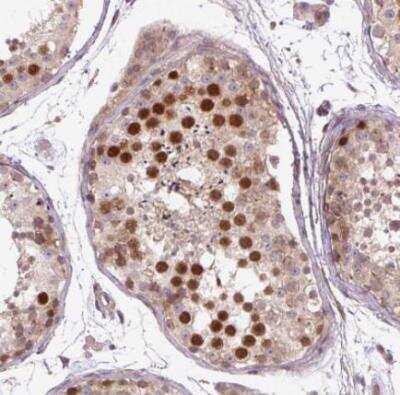 Immunohistochemistry-Paraffin: KIFC1 Antibody [NBP2-47407]