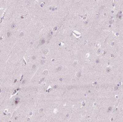 Immunohistochemistry-Paraffin: KIFC1 Antibody [NBP2-47407]