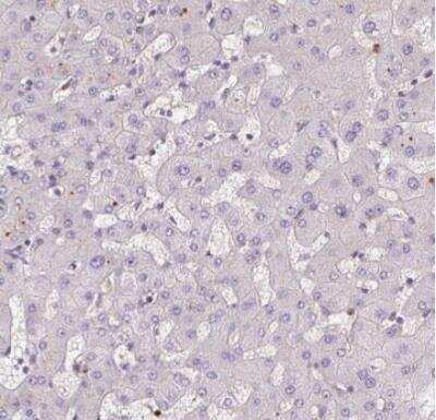 Immunohistochemistry-Paraffin: KIFC1 Antibody [NBP2-47407]