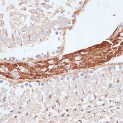 Immunohistochemistry-Paraffin: KIFC1 Antibody - Azide and BSA Free [NBP3-04585]