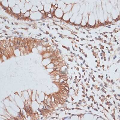 Immunohistochemistry-Paraffin: KIFC1 Antibody - Azide and BSA Free [NBP3-04585]