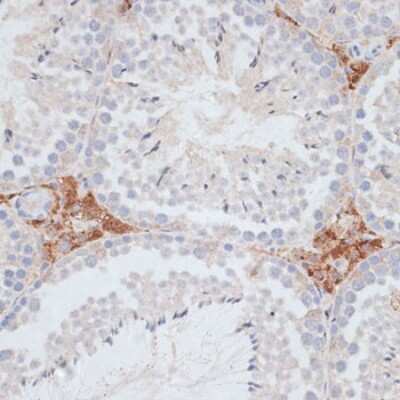 Immunohistochemistry-Paraffin: KIFC1 Antibody - Azide and BSA Free [NBP3-04585]