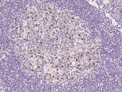 Immunohistochemistry-Paraffin: KIFC1 Antibody [NBP3-06407]