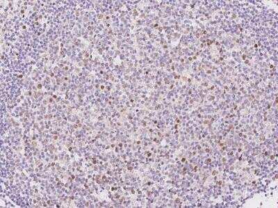 Immunohistochemistry-Paraffin: KIFC1 Antibody [NBP3-06407]