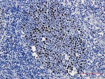 Immunohistochemistry-Paraffin: KIFC1 Antibody (S03-3E4) [NBP3-15052]