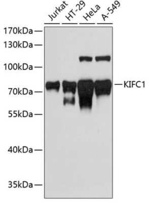 Western Blot: KIFC1 AntibodyAzide and BSA Free [NBP3-04585]