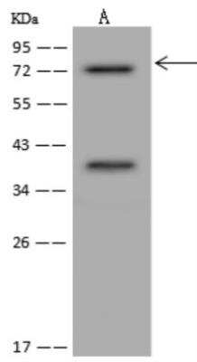 Western Blot: KIFC1 Antibody [NBP3-06407]