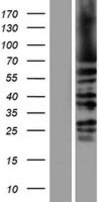 Western Blot: KIFC1 Overexpression Lysate [NBP2-08132]