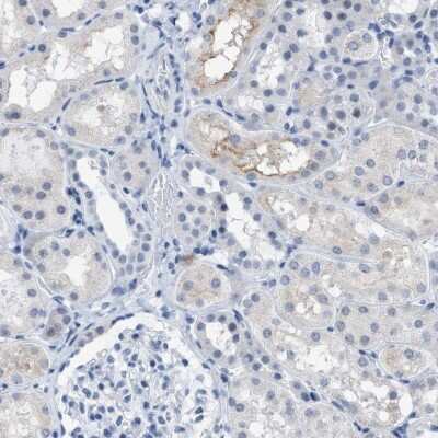 Immunohistochemistry-Paraffin: KIFC3 Antibody [NBP1-86021]