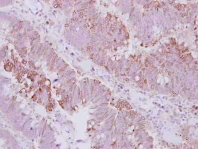 Immunohistochemistry-Paraffin: KIFC3 Antibody [NBP2-17058]