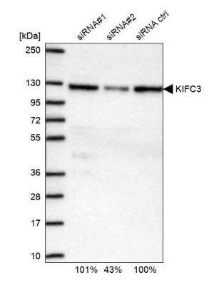 Western Blot: KIFC3 Antibody [NBP1-86021]